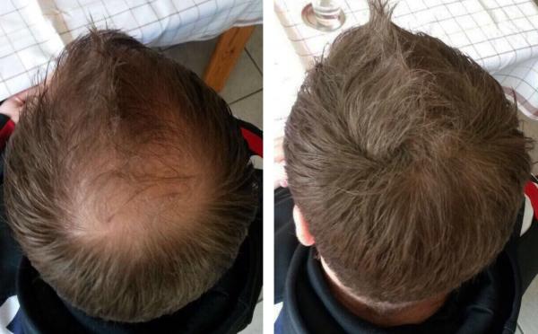 Plus additional hair Haarauffüller - ROSTBRAUN - Schütthaar - Streuhaar - Haarverdichtung - Haarfasern - für Männer & Frauen